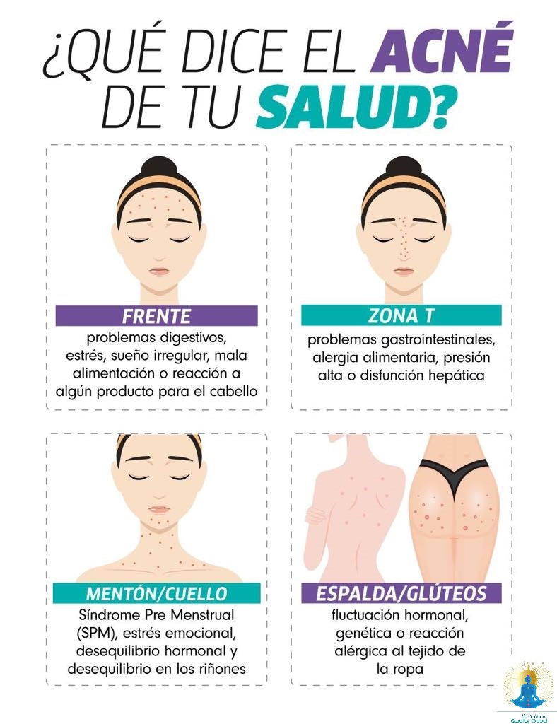 Mascarilla astringente antibacterial es un producto ideal en la prevención y tratamiento de estética y dermatocosmetica natural para acné. Es excelente para la limpieza e higiene de la piel brillante, controla la propagación bacteriana, retirara la suciedad acumulada, absorbe y elimina excesos de grasa.